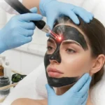hollywood peel 2