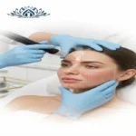 laserresurfacing 